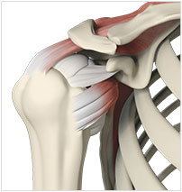 Rotator cuff sparing